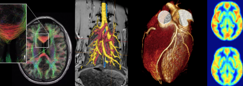 Medical Imaging